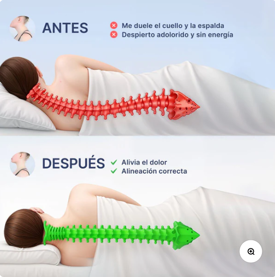 Cervilisse La solucion a tus sueños